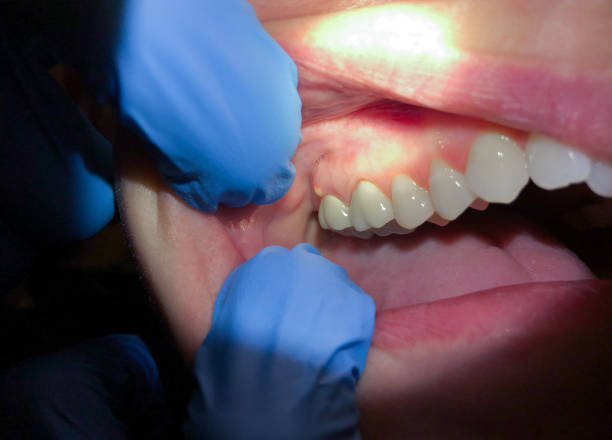 Best Cracked Tooth Emergency Dentist  in Winter Garden, FL